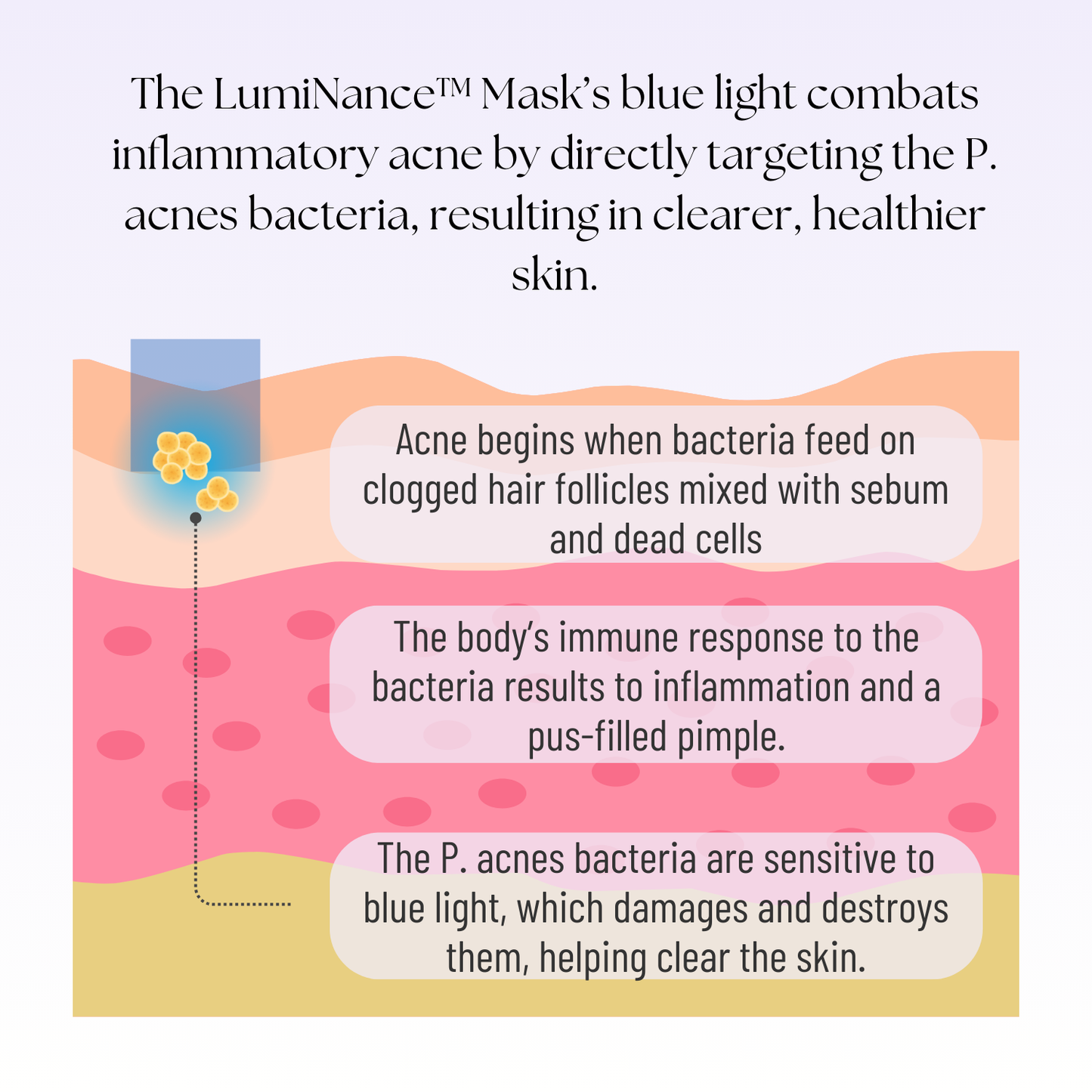 LumiNance™ Mask